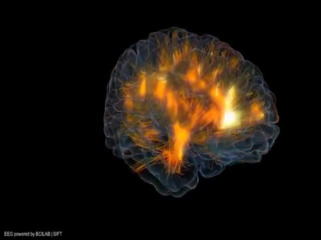 3D Brain Visualization How does the mind work, 3d, Brain, Mind, Human, Body, Science Technology