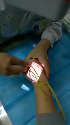 Visible veins, more accurate branel placement - Video & GIFs | visible,sience,veins,catheter,bran,bran ul,science technology