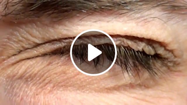 Eye slow motion, crazy, awesome, jiggly, weird, cool, eye, motion, slow, nature travel. #0