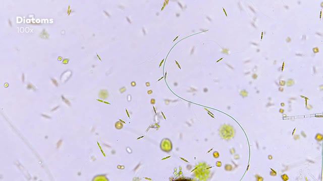 Microcosmos, microbiology, microorganisms, bacteria, microscope, tardigrade, water bear, jam's germs, single cell, hank green, andrew huang, diatoms, sci fi, music, post new age, science technology.
